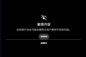 惊悚！慎看！范德彪小拇指骨头突出可见！